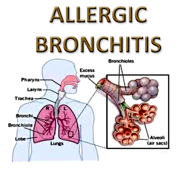 Allergic Bronchitis